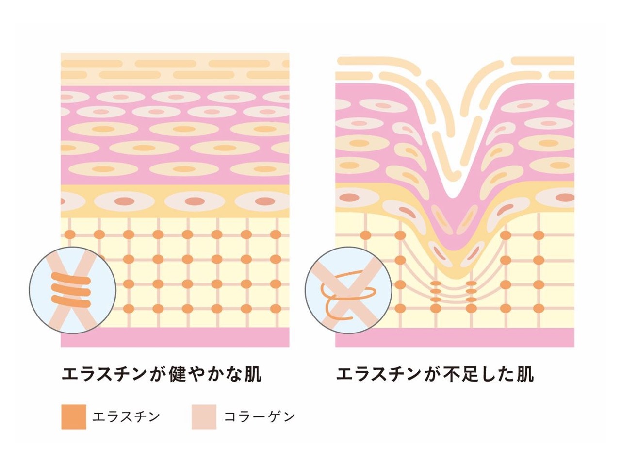 エラスチンが健やかな肌と不足した肌の断面図